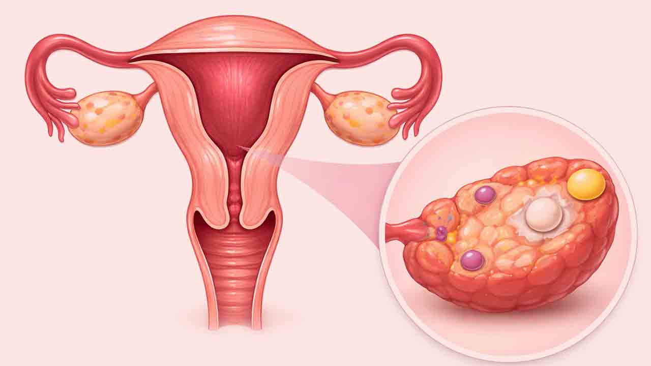 5 fatos sobre os ovários que toda mulher deveria saber