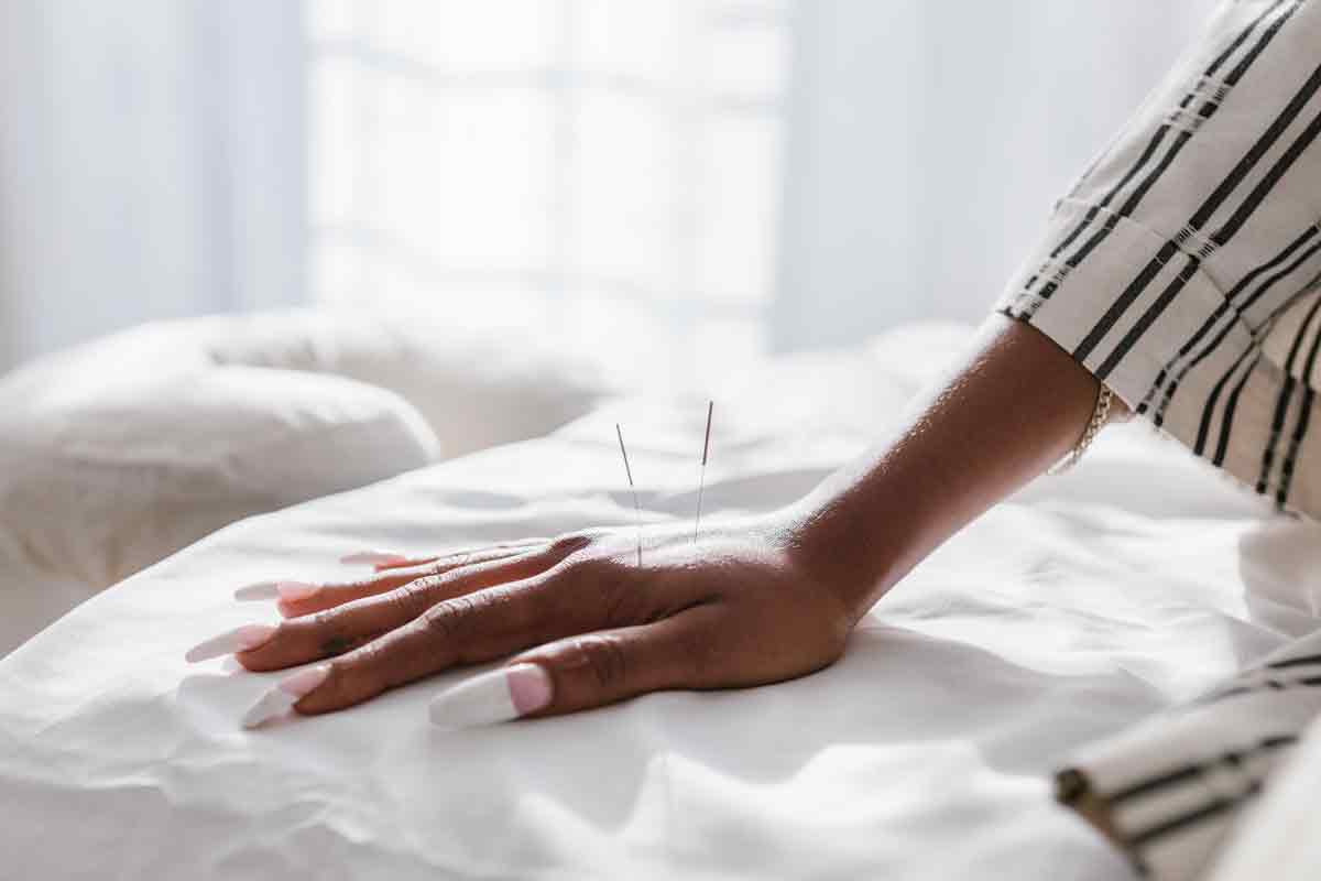 Acupuncture helps in the treatment of anxiety and depression. Photo: Pexels
