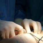 Consequências da trombose podem levar à morte; conheça os sintomas e saiba como prevenir. Foto: pexels