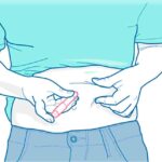 Remédio para diabetes usado para emagrecer tem efeitos colaterais adversos