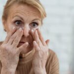 Quais são os riscos do lifting facial, cirurgia para eliminar rugas