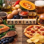 Alimentos que podem piorar a psoríase — e os que podem ajudar a aliviar os sintomas. Ilustração: Condutta