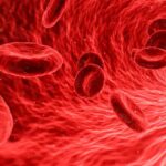 O que é anemia falciforme