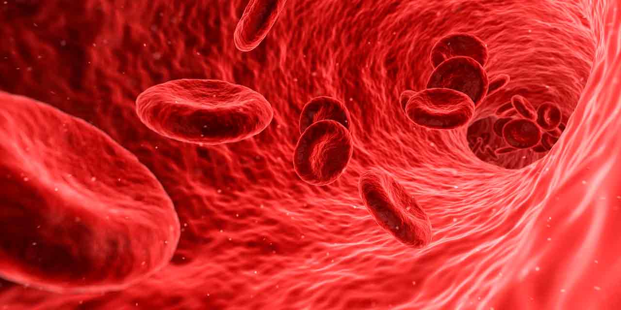 什么是镰状细胞性贫血