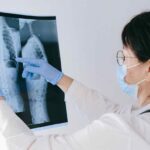 O que é o câncer de osteossarcoma?