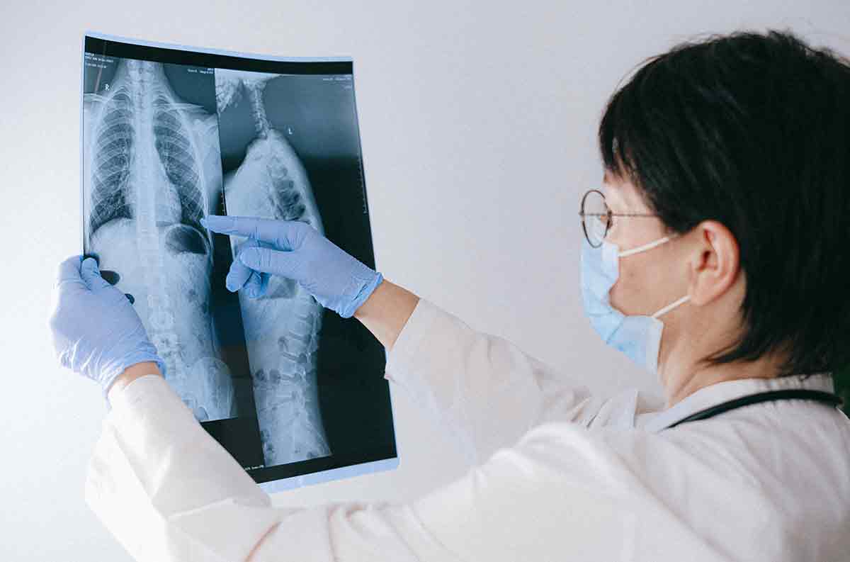 O que é o câncer de osteossarcoma?