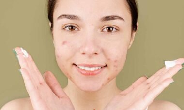 Dicas para se livrar das acnes rapidamente, de acordo com dermatologistas. Foto: pexels