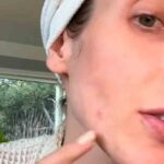 Vídeo: Dermatologista revela o tipo de espinha que você NUNCA deve espremer. Fotos e vídeos: Tiktok @drsamanthaellis