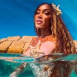 A modelo Winnie Harlow tem Virtiligo. Instagram @winnieharlow