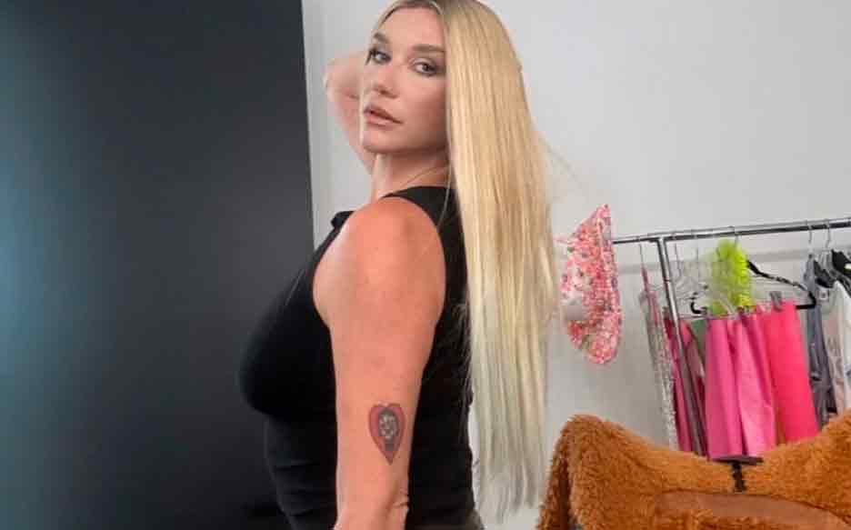 Kesha. Instagram @kesha